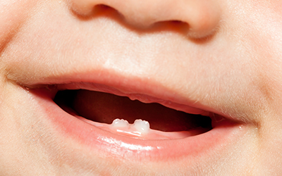 Teething Tips Every Parent Should Know