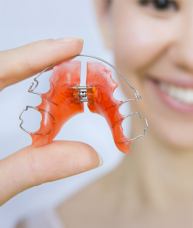 Woman holding a palatal expander